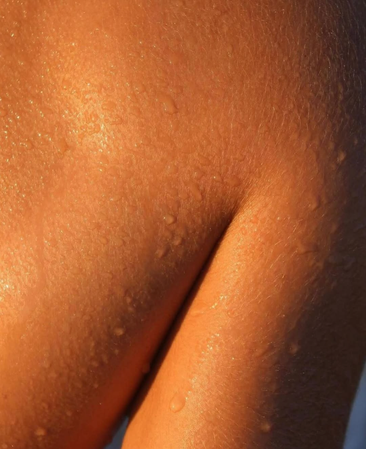 TERLEME VE VÜCUT KOKUSU