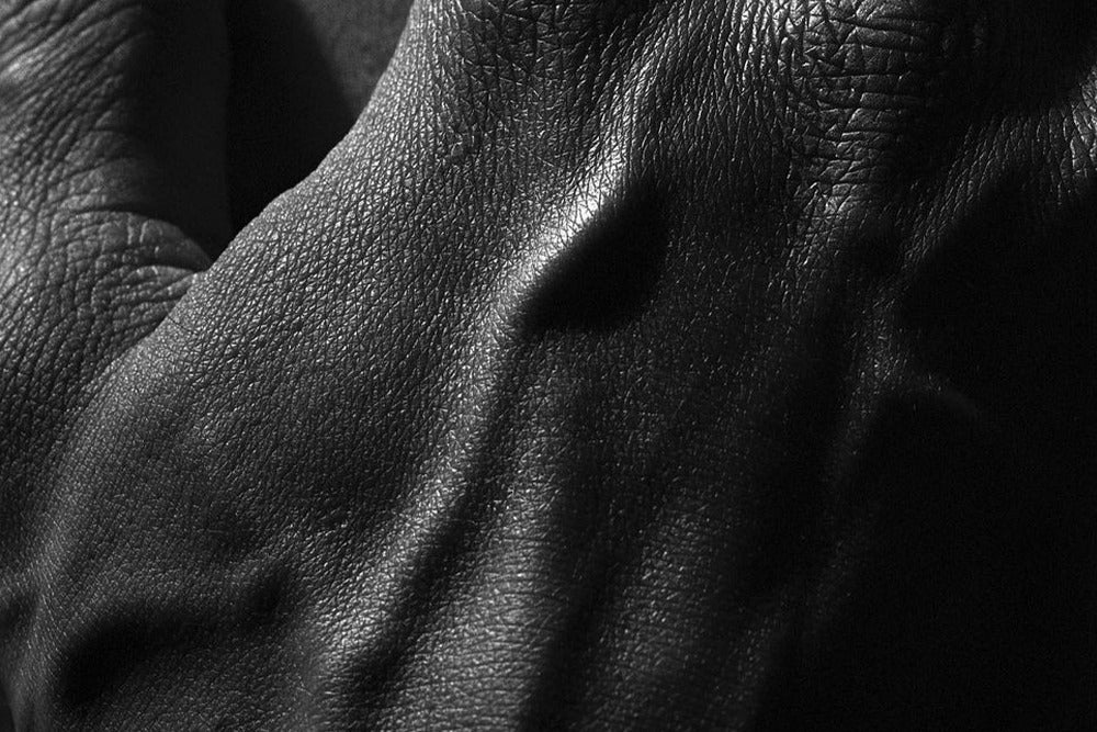 KIŞ CİLDİMİZİ NASIL ETKİLER?